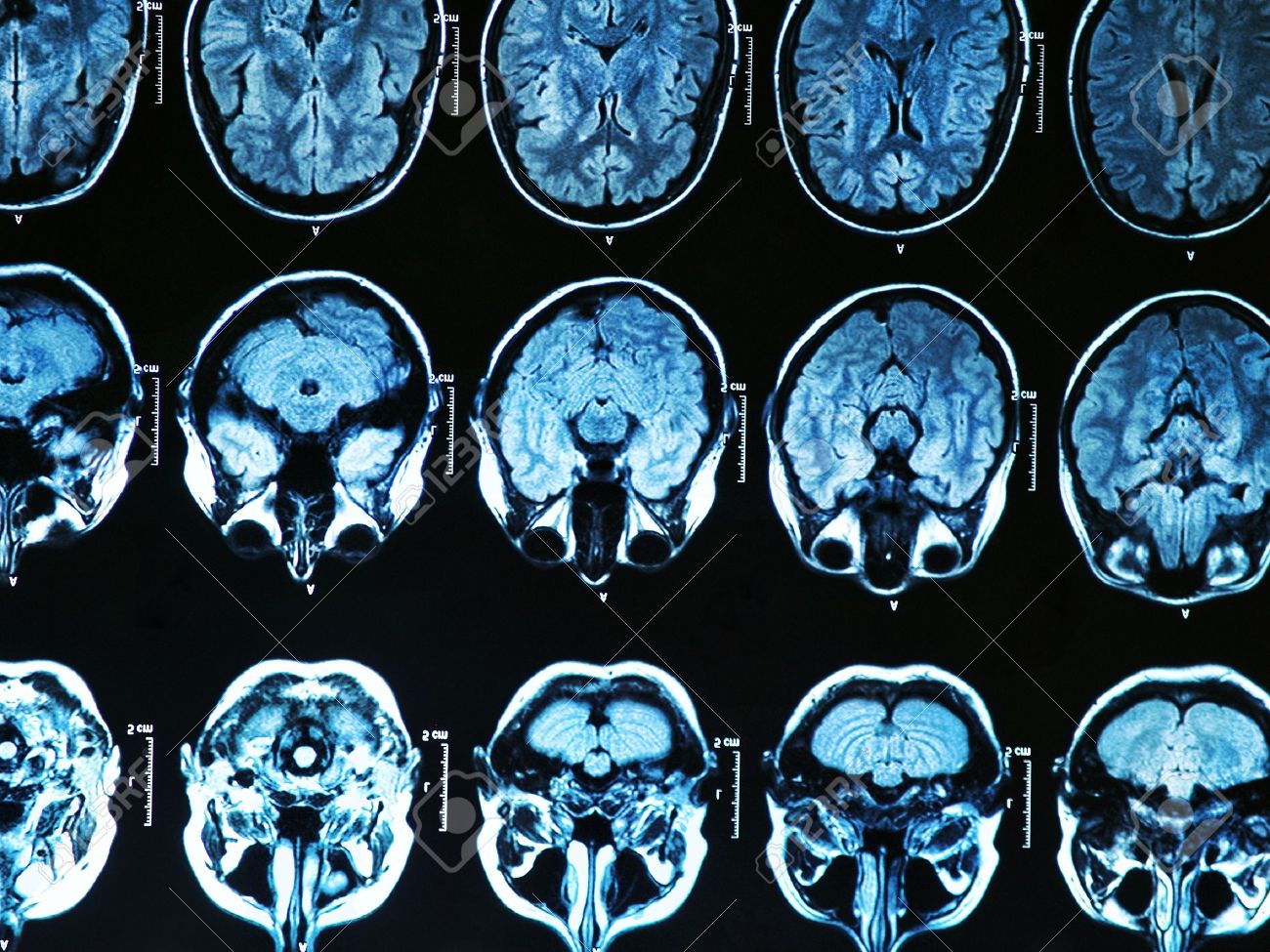 Görüntüleme Merkezlerinde Karşılaşılan Sorunlar